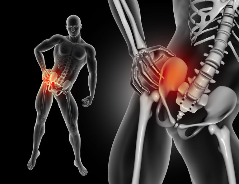 does-chronic-hip-pain-require-hip-replacement-surgery-froggy-and-the